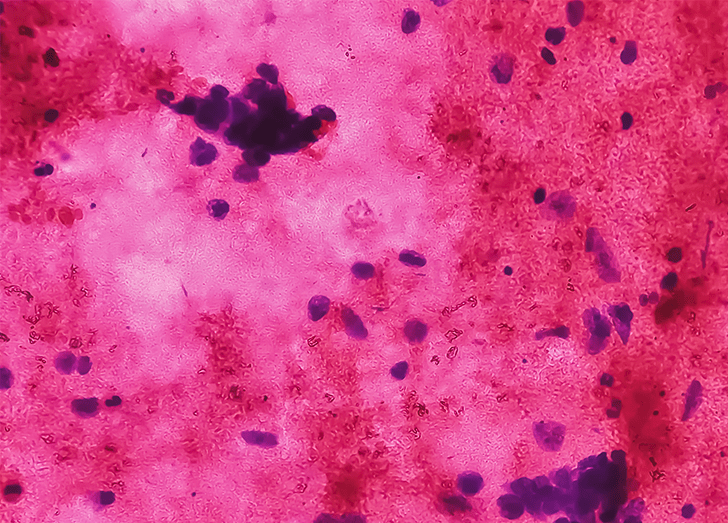 Cytology test.