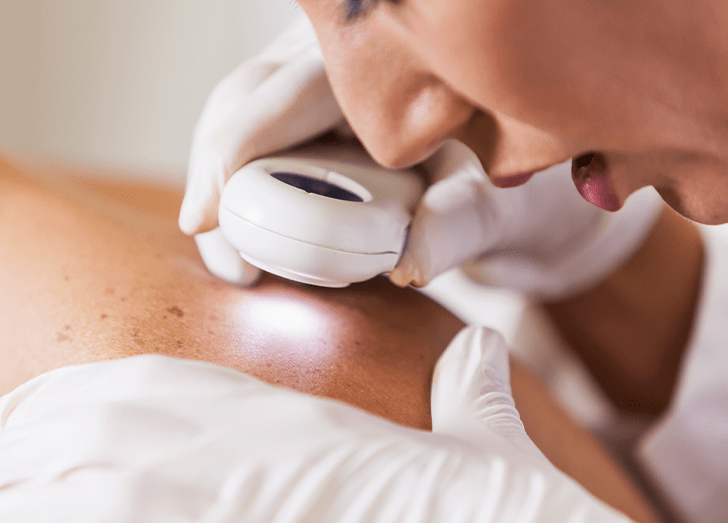 Dermatologist examining patient for signs of skin cancer.