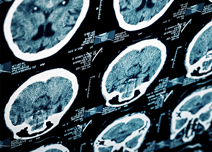 mri of brain.