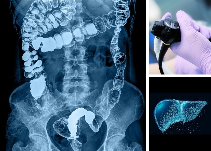 Hero image with GI tract, endoscope, liver