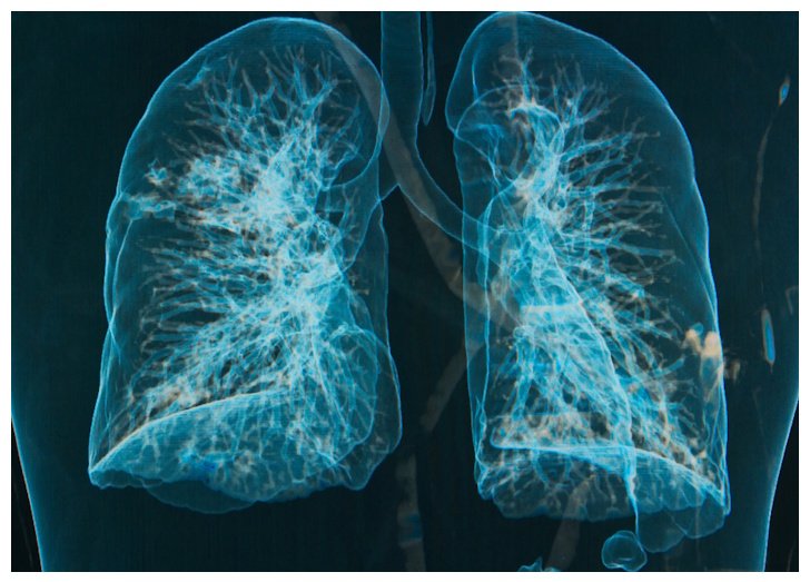 3D lung imaging