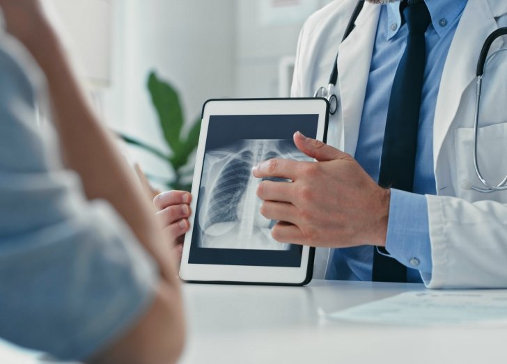 doctor showing patient an x ray of their lungs