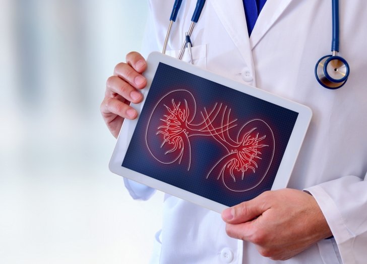 doctor holding an ipad with an image of kideny's on the screen.
