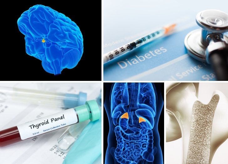 Endocrinology mixed image