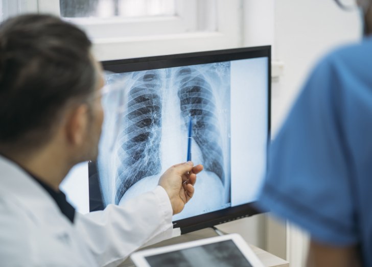 two doctors looking at the lung x ray.