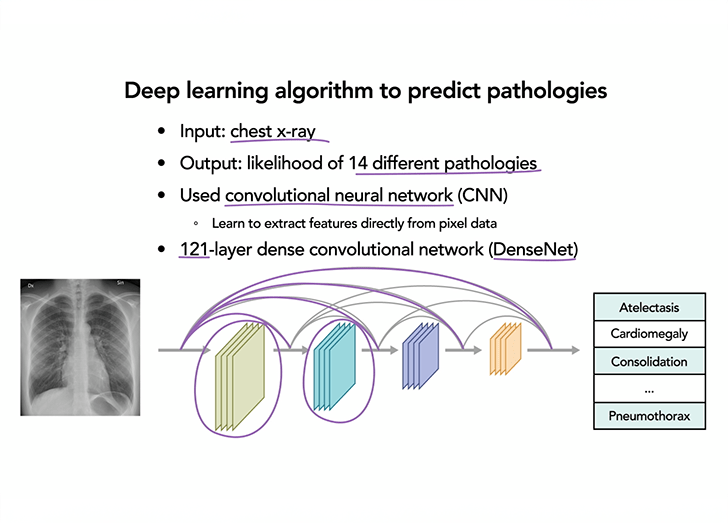 Deep learning algorithim to predict pathologies