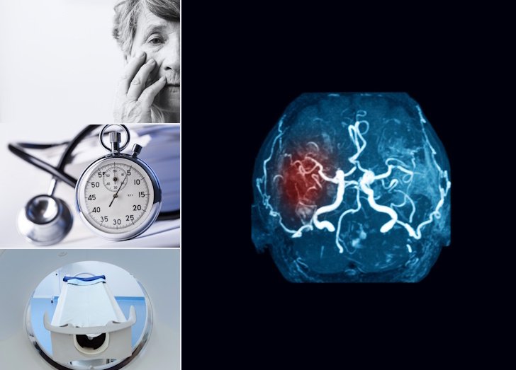 Brain with mass, confused woman, ticking stopwatch, MRI machine