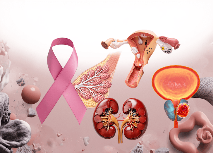 Different medical images of womens health, including a breast, a uterus and kidneys.