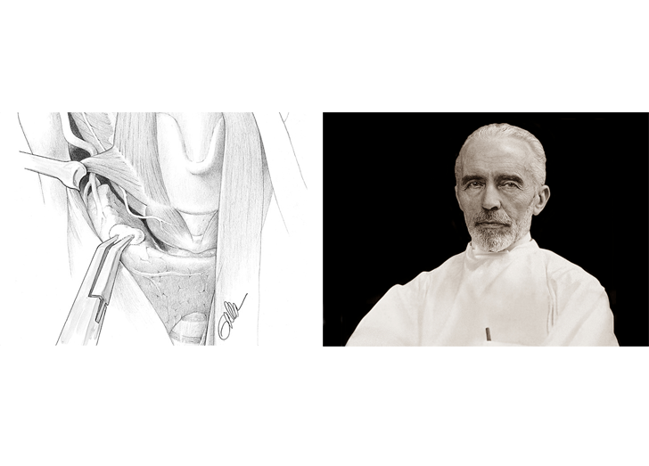 An image of the anatomical structure of the thyroid gland and a man.