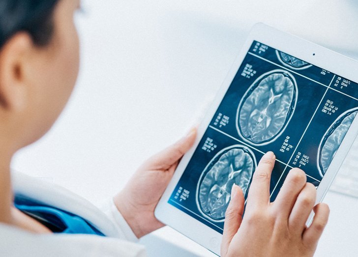 females doctor looking at x ray scan of brain on an ipad.