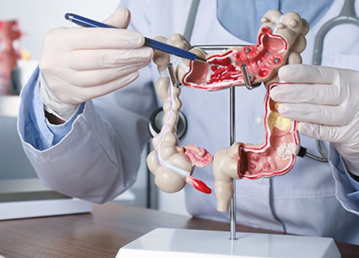 Image of doctor showing a replica of the Gastrointestinal.