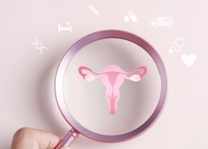 Image of uterus under a magnifying glass.