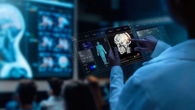 A doctor examining scans of a brain. 