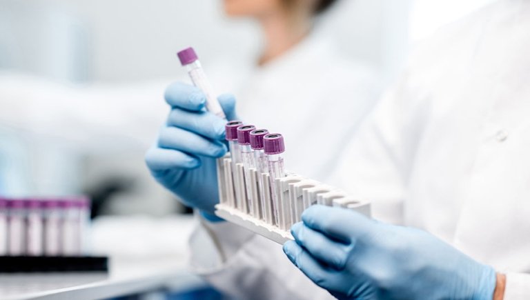 A zoomed in photo of a scientist in medical gloves holding test tubes.