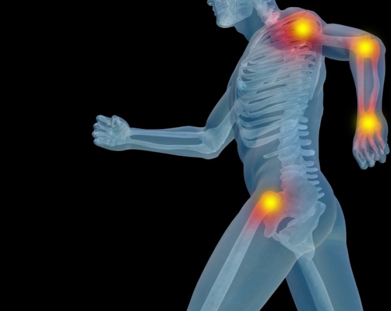 X-ray illustration of running person with joints marked with hot yellow circles