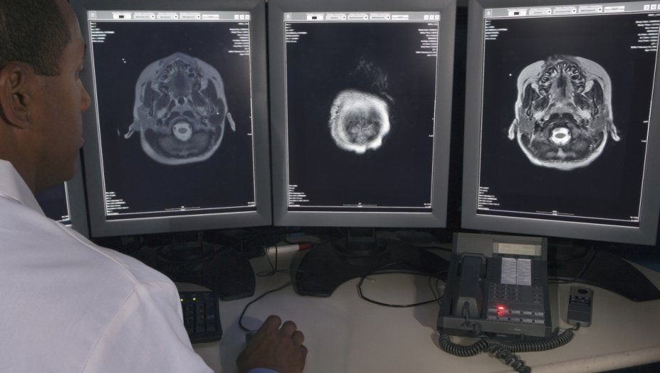 A health care provider looking at three different scans of a brain.
