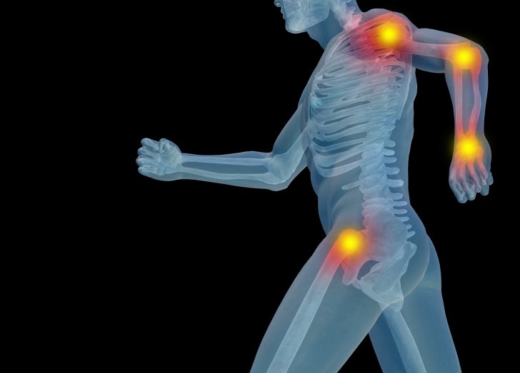 X-ray illustration of running person with joints marked with hot yellow circles